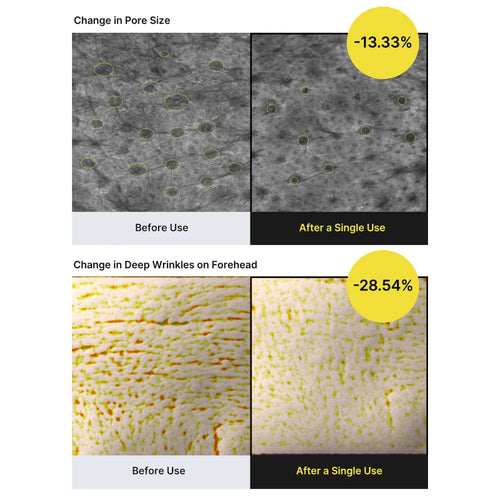Retinal Renewal Shot