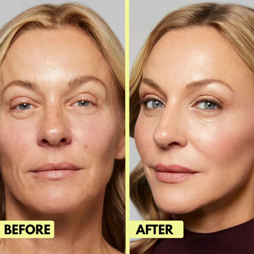 Retinal Renewal Shot